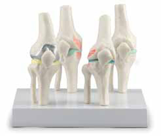 Knee Joints Set